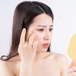 rekomendasi-skincare-jerawat-paling-ampuh-panduan-lengkap-menuju-kulit-bebas-jerawat