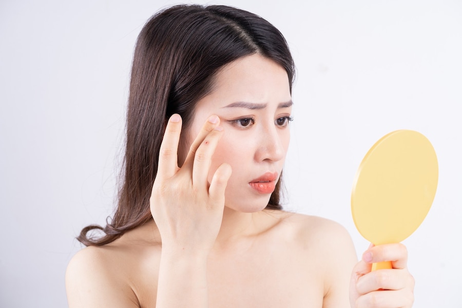 Rekomendasi Skincare Jerawat Paling Ampuh: Panduan Lengkap Menuju Kulit Bebas Jerawat